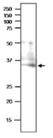 PBP1 | PYK10-binding protein 1 (N-terminal) in the group Antibodies Plant/Algal / Environmental Stress / Wounding at Agrisera AB (Antibodies for research) (AS20 4414)